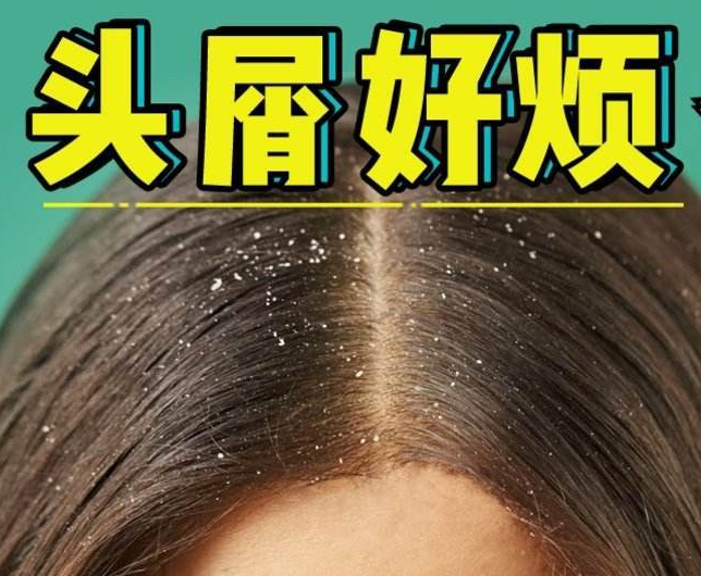 南寧正規(guī)美發(fā)培訓(xùn)學(xué)校分享：冬天如何減少頭屑過多？