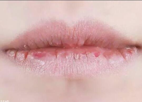 紋唇后嘴巴干燥怎么辦？南寧教紋繡的學(xué)校幫你解決