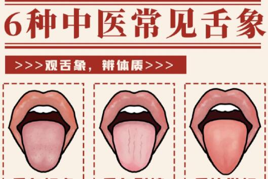 6種常見中醫(yī)舌診判定，快和廣西中醫(yī)美容一起學(xué)