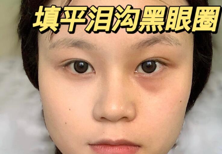 填平淚溝黑眼圈教程，廣西南寧化妝學校分享