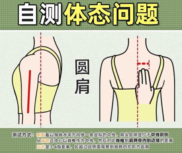 你真的是駝背嗎？廣西美容美體學(xué)校教你自測