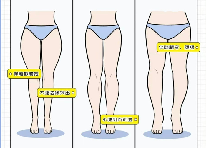 腿粗女生穿搭攻略，廣西彩妝造型搭配