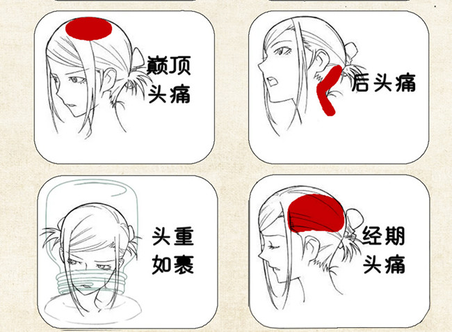 不同頭痛類型經(jīng)絡(luò)護(hù)理方法，廣西中醫(yī)美容培訓(xùn)
