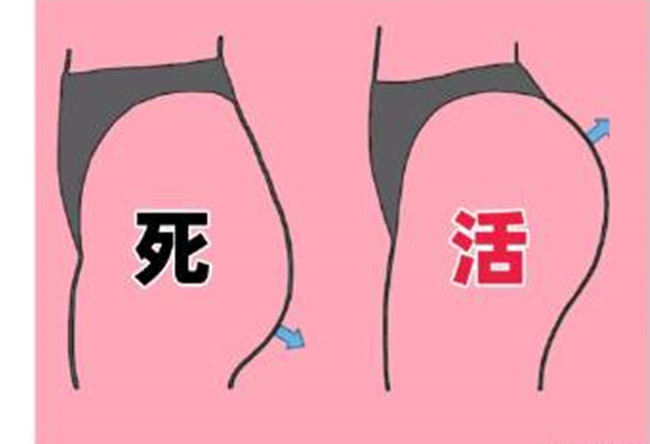 如何改善你臀部的健康情況？南寧美容形象